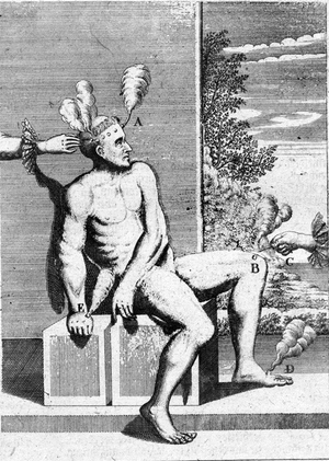 An image of moxibustion in Michael Bernhard Valentini’s Museum museorum (1714).